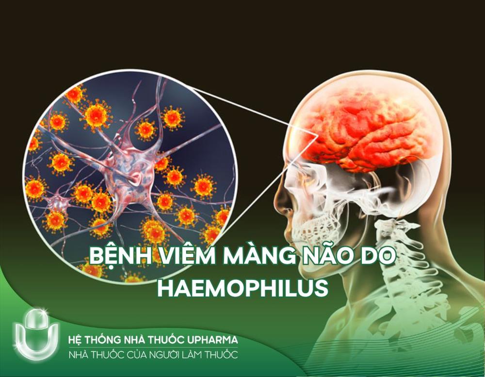 Hiểu về bệnh viêm màng não do Haemophilus influenzae type b