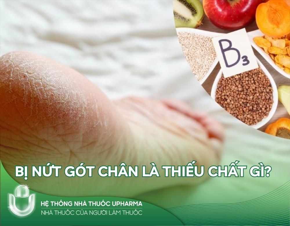 Hỏi đáp: Bị nứt gót chân là thiếu chất gì?