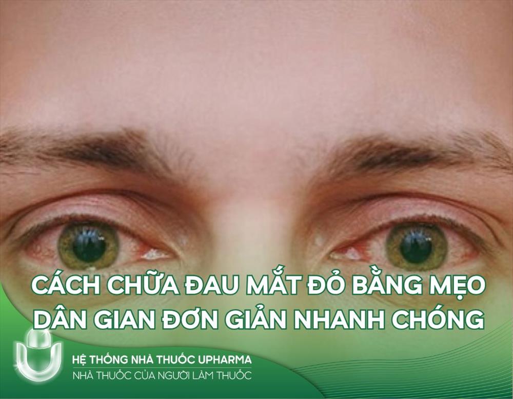 Cách chữa đau mắt đỏ bằng mẹo dân gian đơn giản nhanh chóng