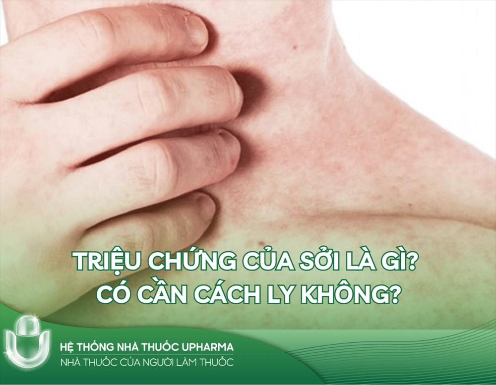 Triệu chứng của sởi là gì? Có cần cách ly không?